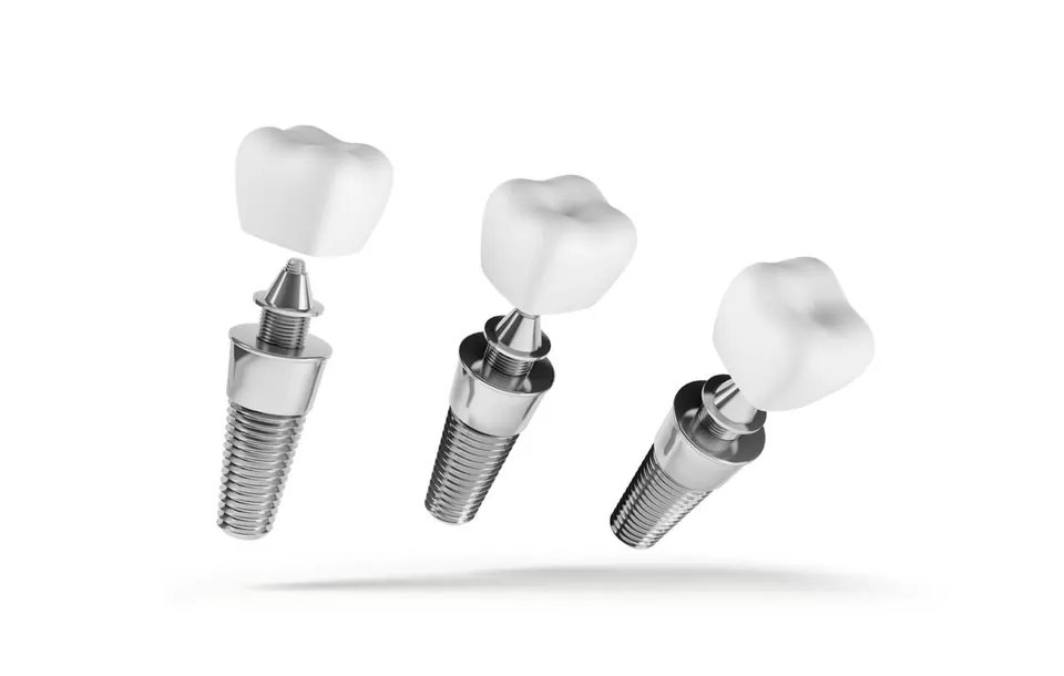 Multiple dental implants in Bodrum, Turkey