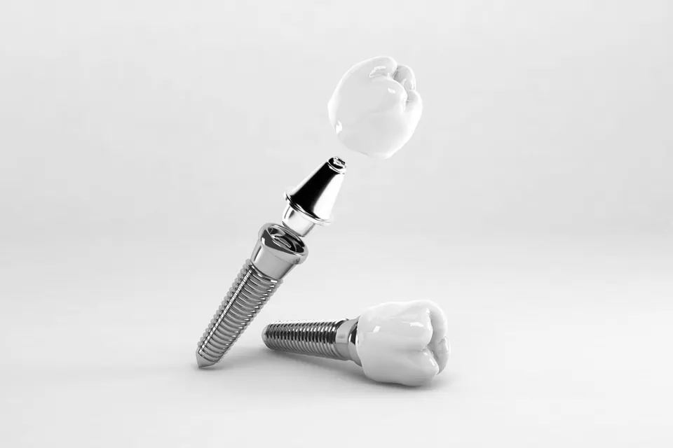 Single dental implant in Bodrum, Turkey