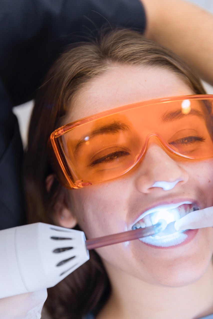 Teeth whitening for a brighter smile