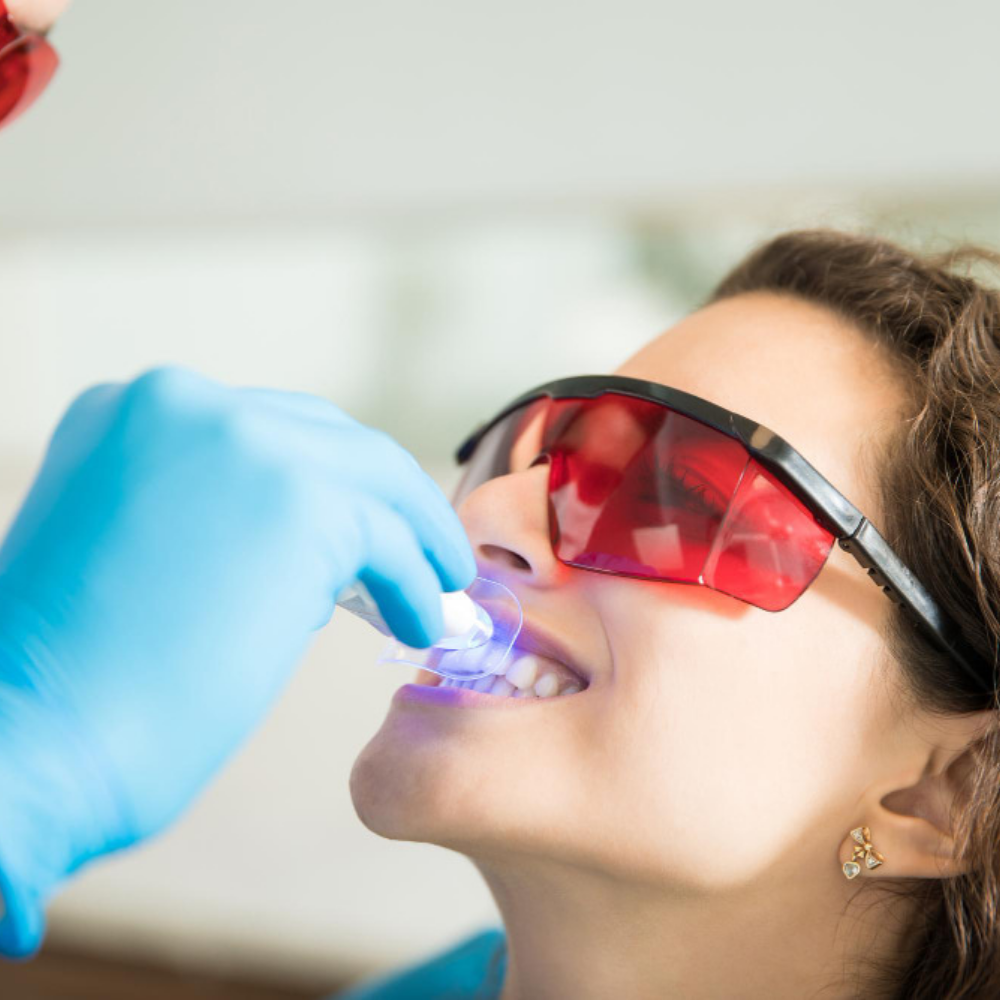 Professional in-office teeth whitening at MandarinDent Bodrum