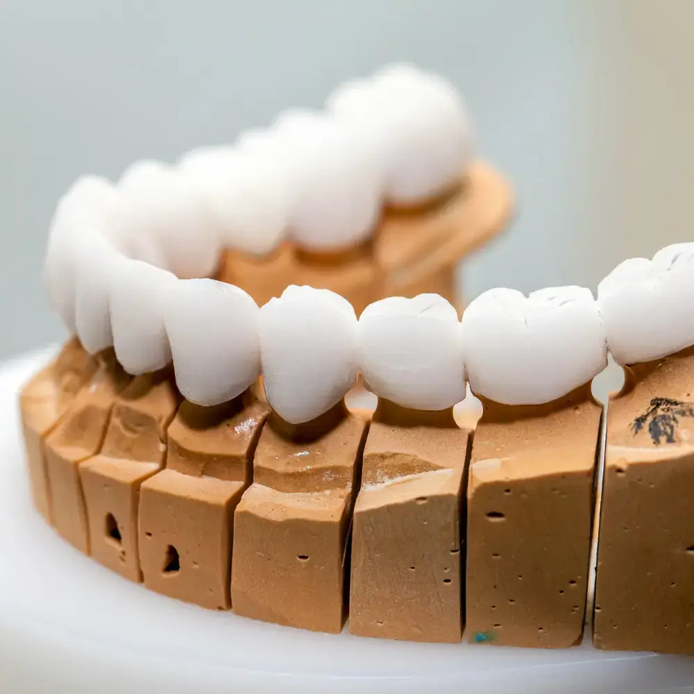 Zirconia crowns crafted for a natural smile at MandarinDent Bodrum